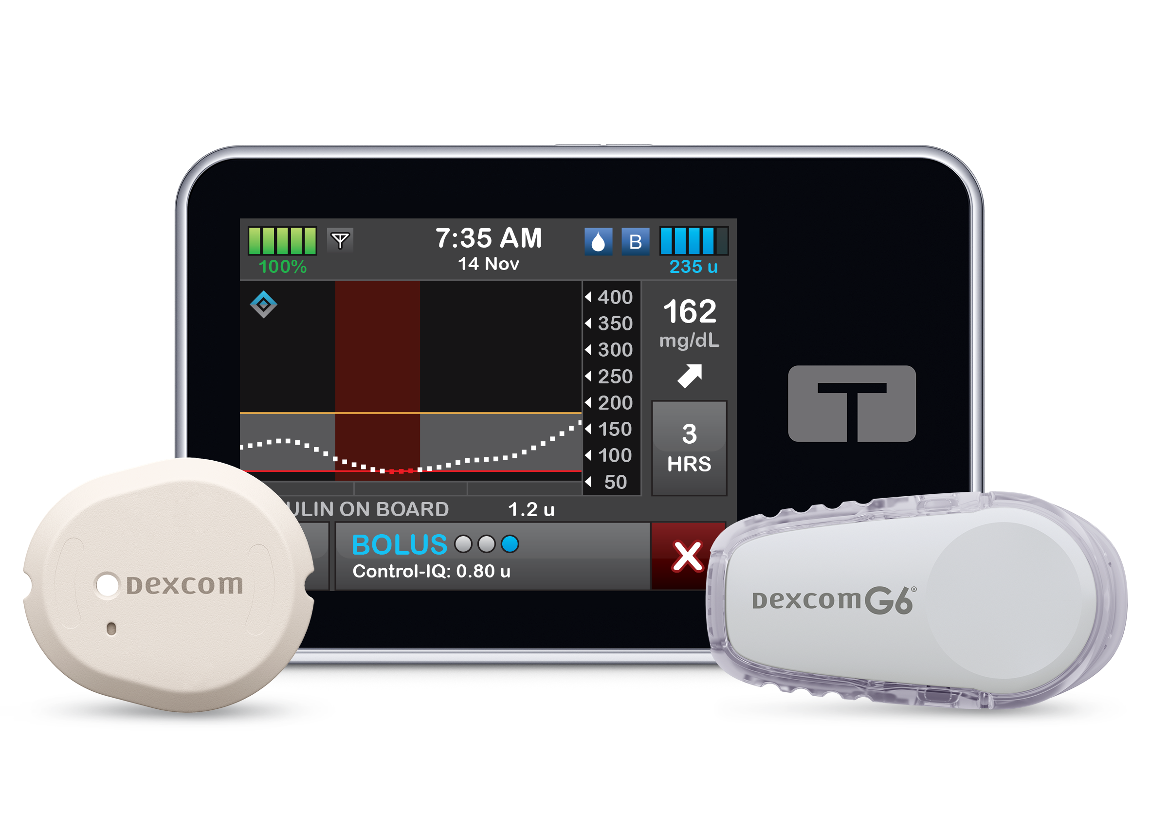 pompe à insuline t:slim X2 avec CGM Dexcom G6 et G7