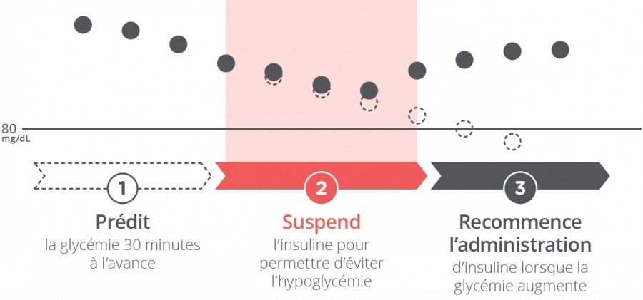 Graphique explicatif sur la technologie BASAL-IQ