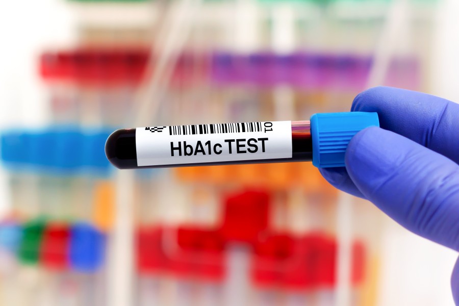 Test d'hémoglobine glyquée ou HbA1c