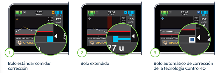 Iconos de bolos en el gráfico de MCG