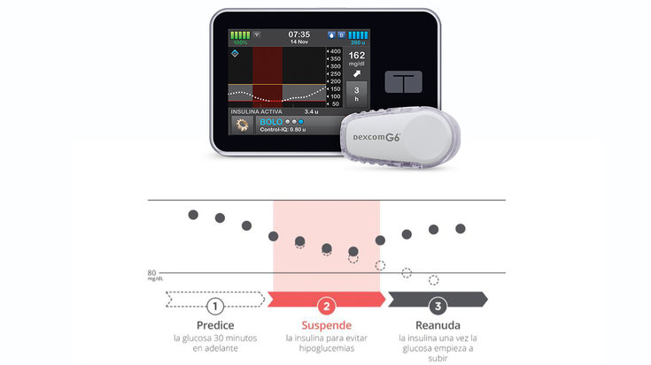 ¿Qué es la tecnología Basal-IQ™?