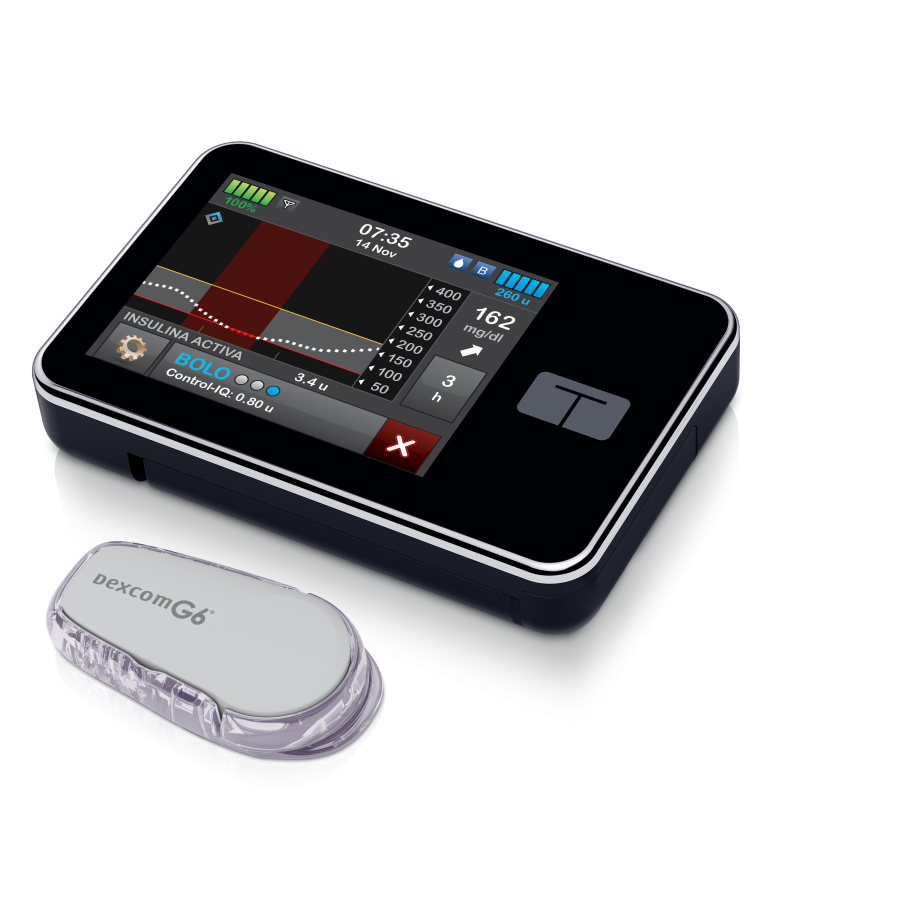 control-iqtm-technology