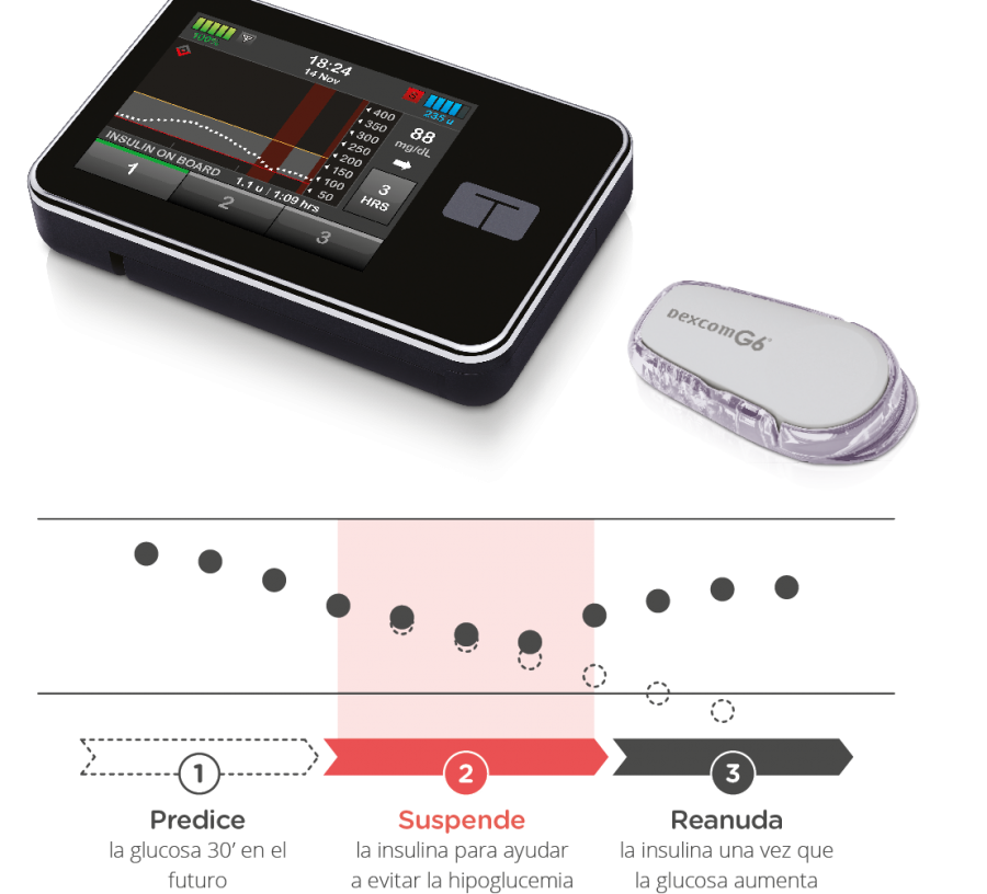 How Basal-IQ Works
