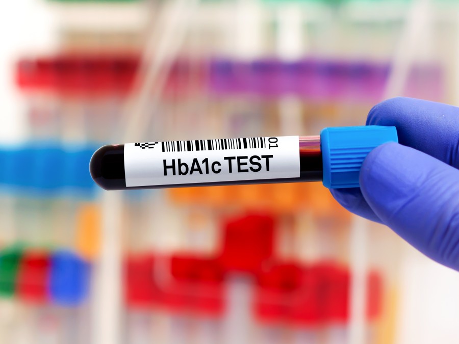 HBA1c