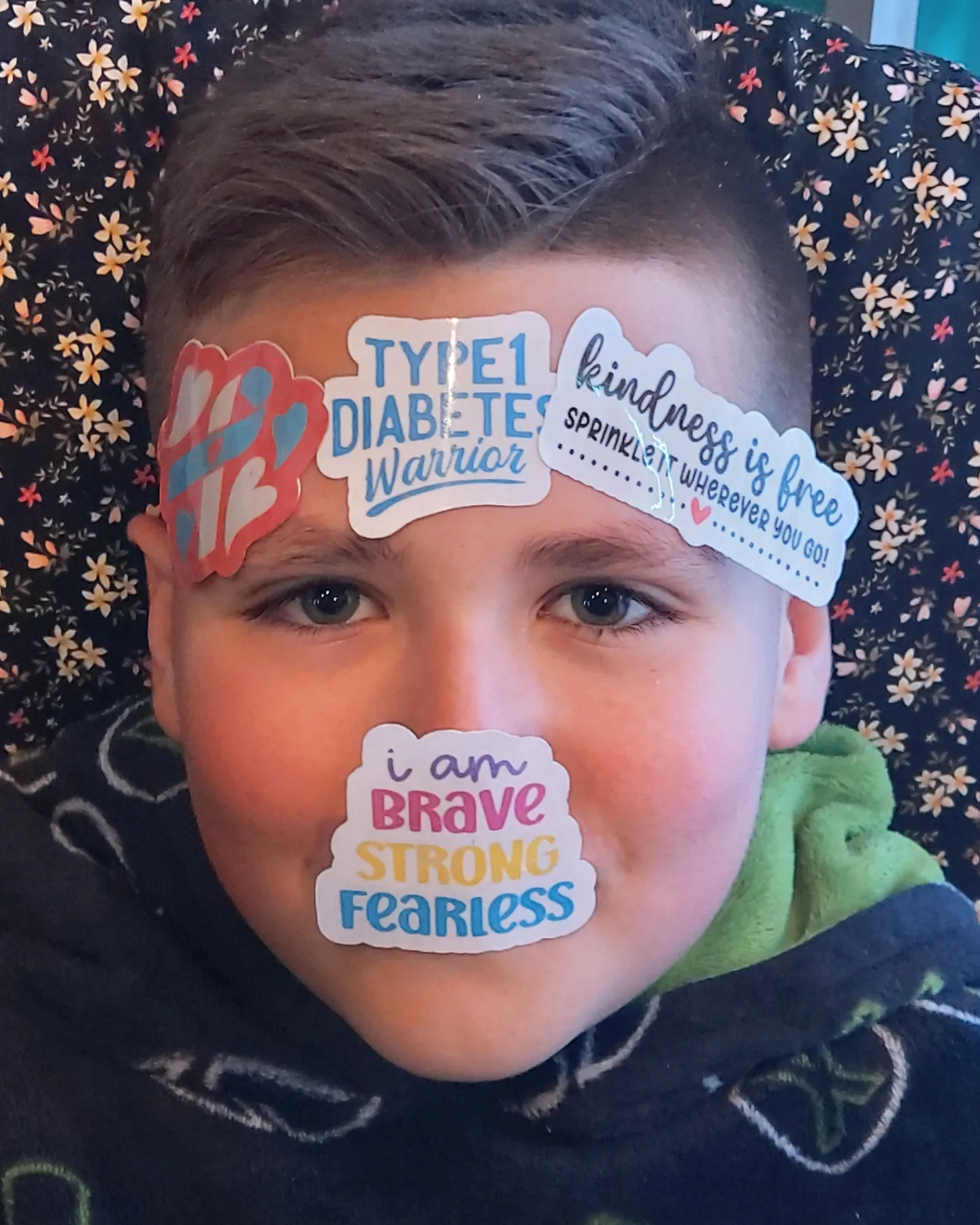 Mylo with fun diabetes based stickers on his face
