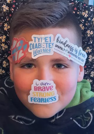 Mylo with fun diabetes based stickers on his face