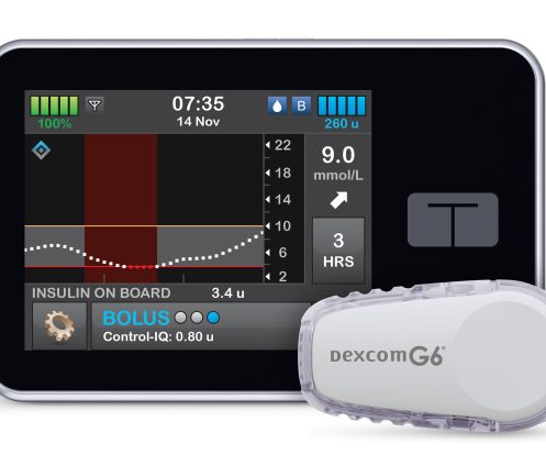 The t:slim X2 with Control-IQ™ Technology and Dexcom G6