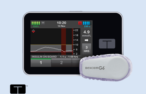 The t:slim X2 with Basal-IQ Technology
