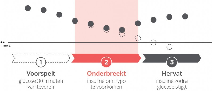 t:slim X2 Insulinepomp met BASAL-IQ Technologie