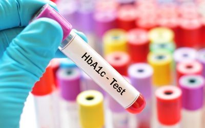 Hyperglycaemia