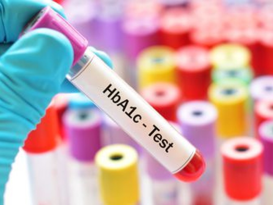 Hyperglycaemia