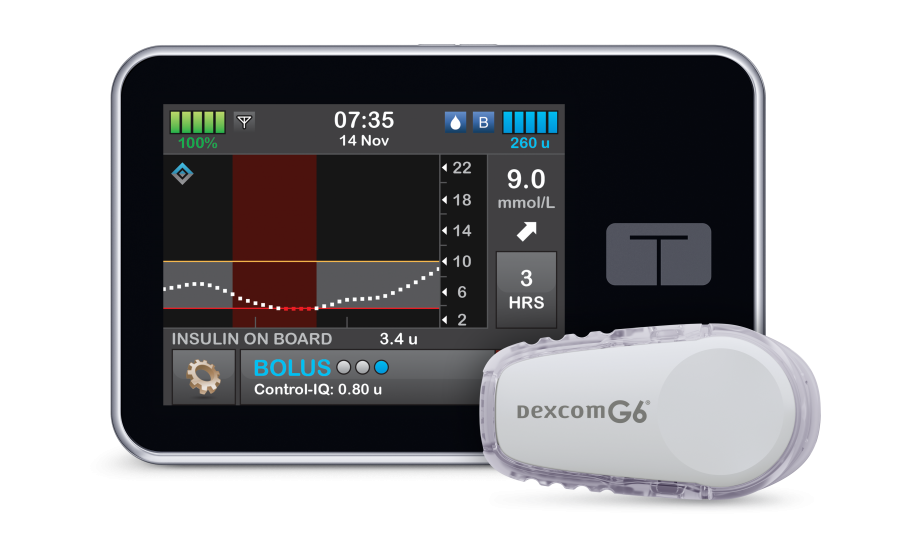 The t:slim X2 with Control-IQ™ Technology and Dexcom G6