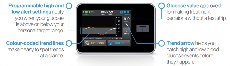 Dexcom_Features