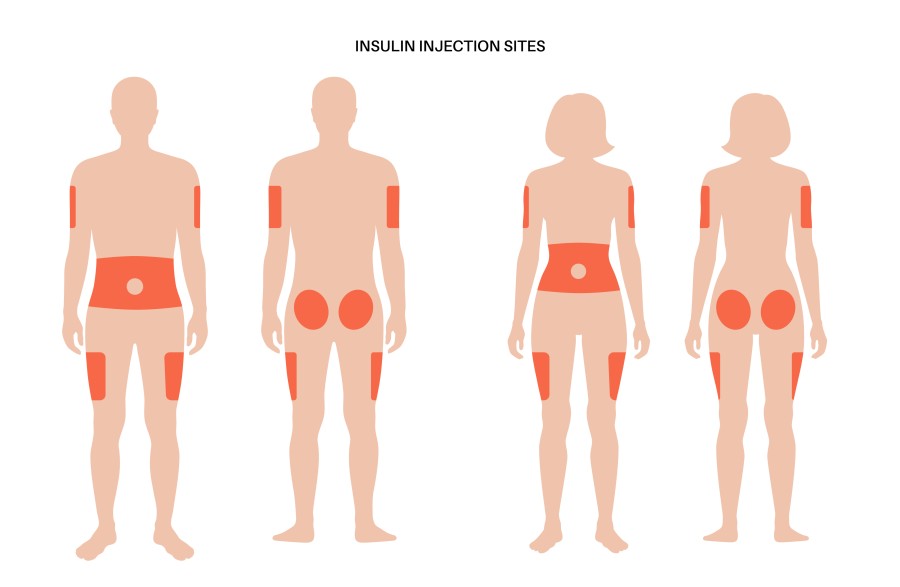 Where can I administer insulin?