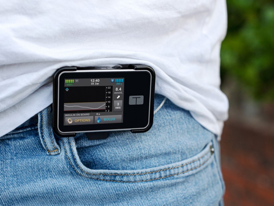 The t:slim X2 Insulin Pump