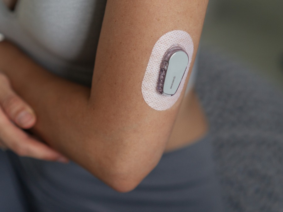 Woman shows her continuous glucose monitor on her upper arm