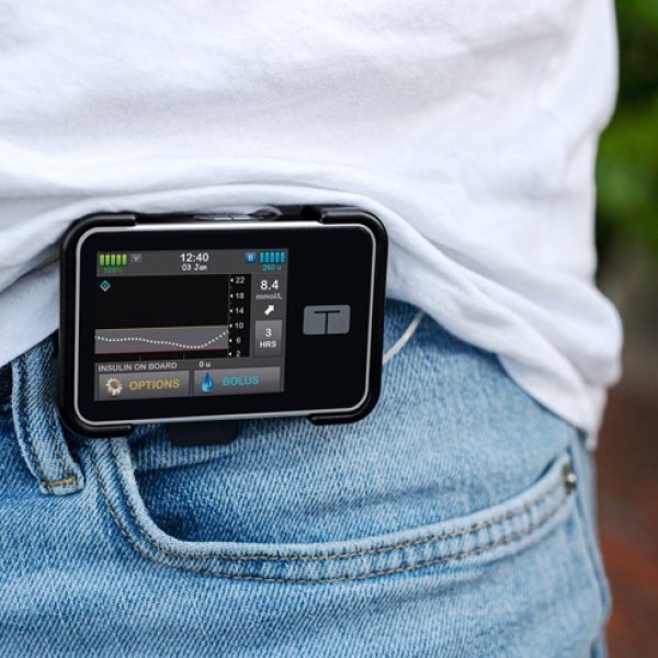 Insulin Pump
